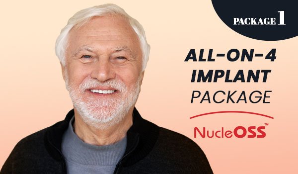 All on 4 Implant Packages