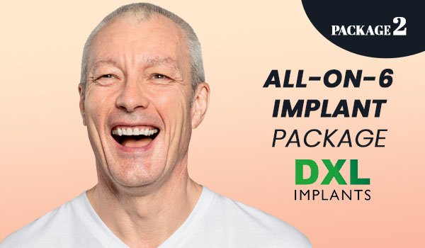 All on 6 Implant Packages