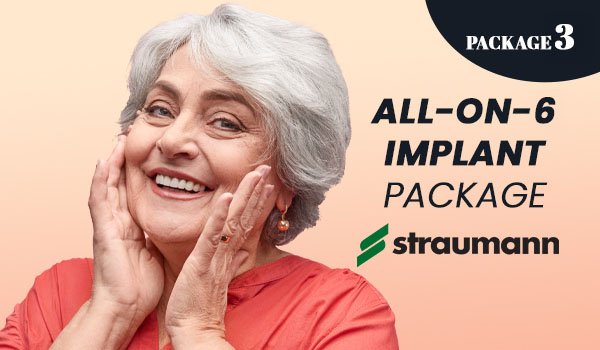 All on 6 Implant Packages