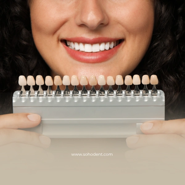 Tam Seramik Diş Kaplama Uygulama, Avantajlar, Bakım – SohoDent