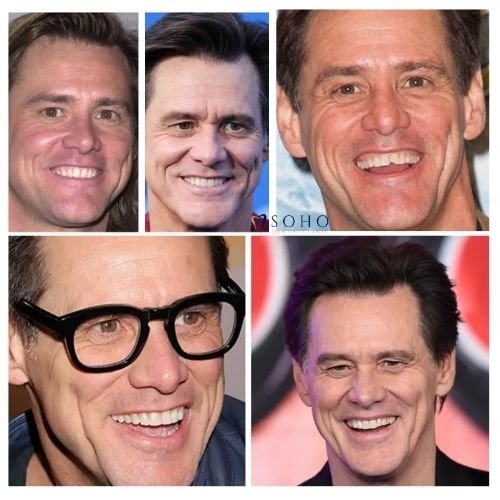 Jim Carrey's Teeth: The Story Behind His Chipped Tooth and Transformation