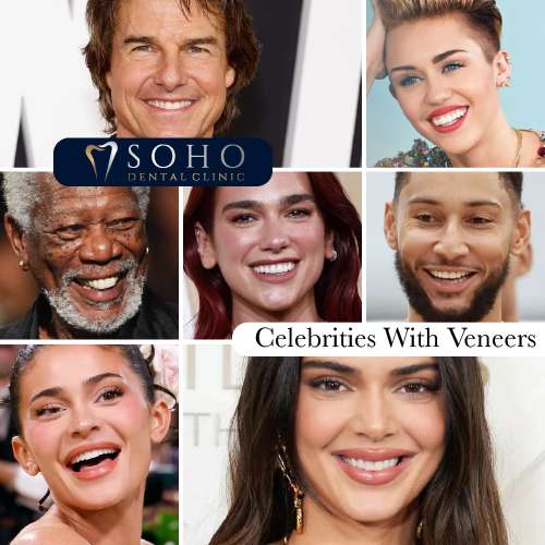 Celebrities With Veneers