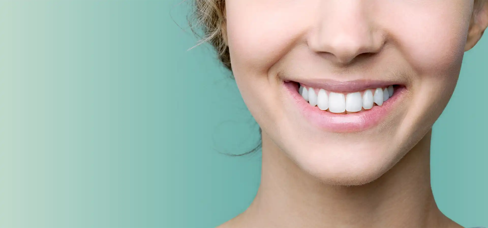 Gummy Smile Tedavisi