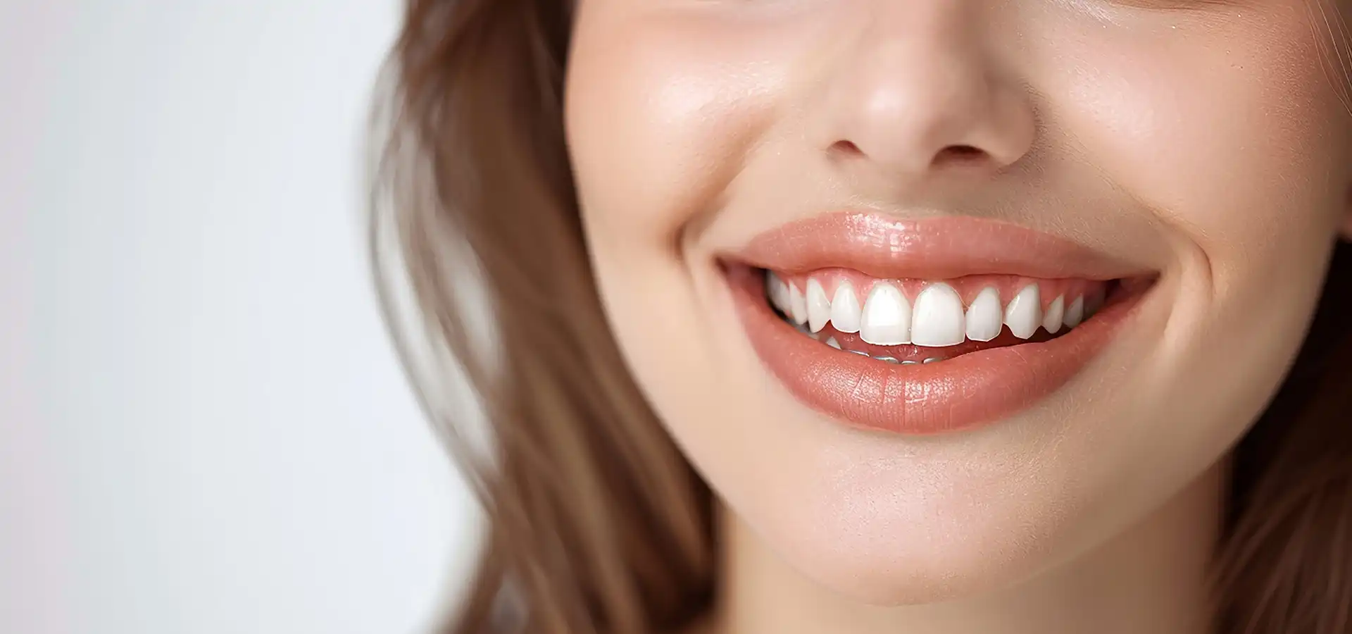 Smile Makeover in Istanbul, Turkey