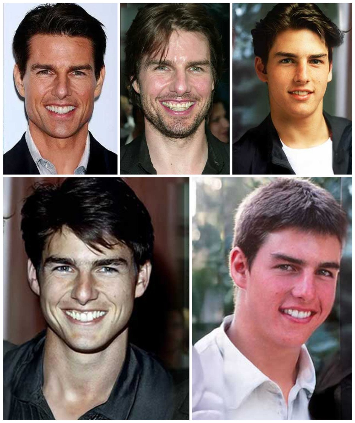 The Story Behind Tom Cruise’s Teeth