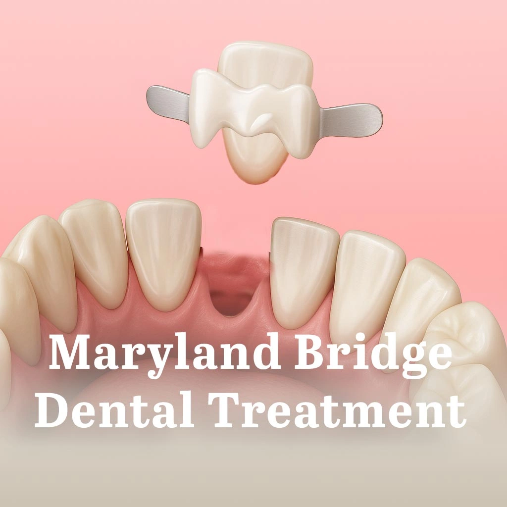 Maryland Bridge Dental Treatment best price turkey