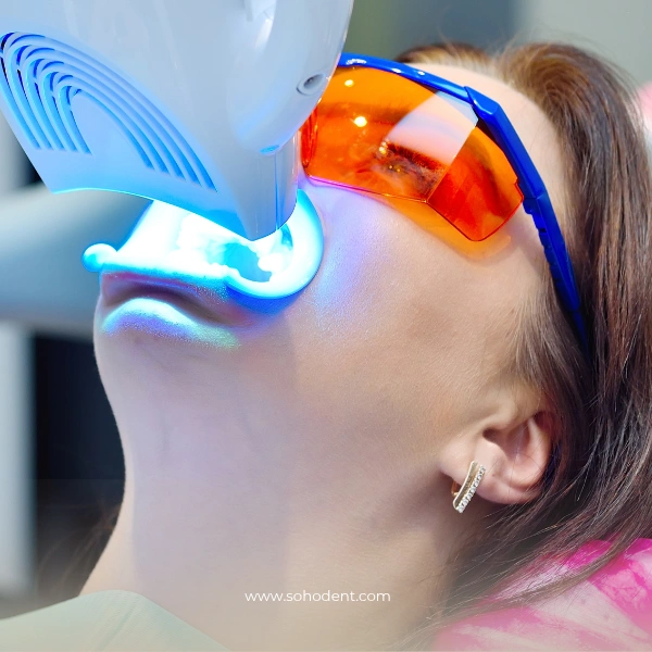 laser teeth whitening in Istanbul.